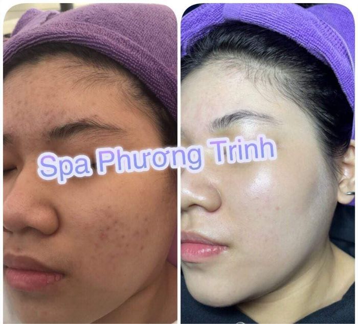 Phuong Trinh Spa Image 1
