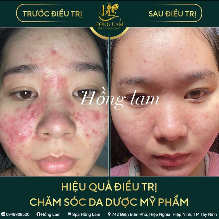 Hong Lam Spa Image 2