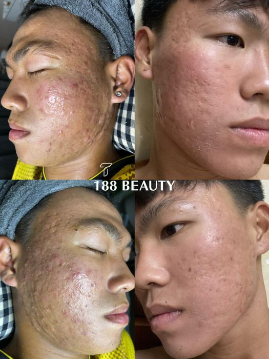 Shynh Beauty Spa Photo 1
