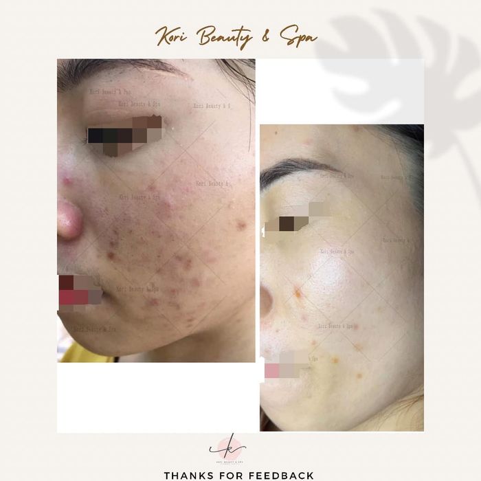 Kori Beauty & Spa Image 1