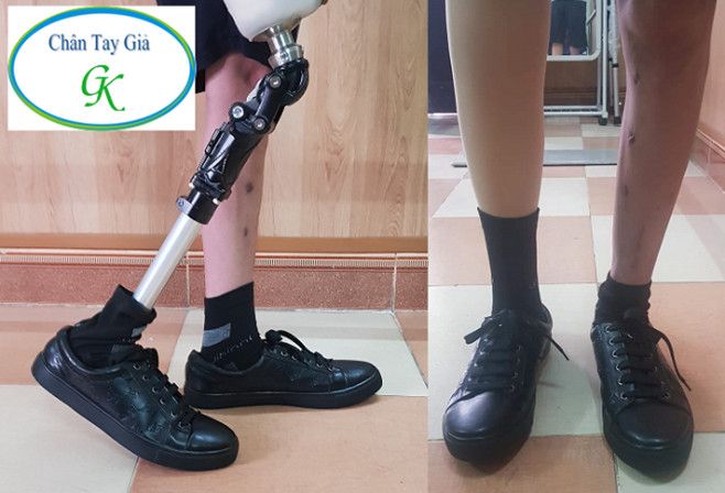 Gia Khiem Prosthetics and Orthopedic Brace Center image 2