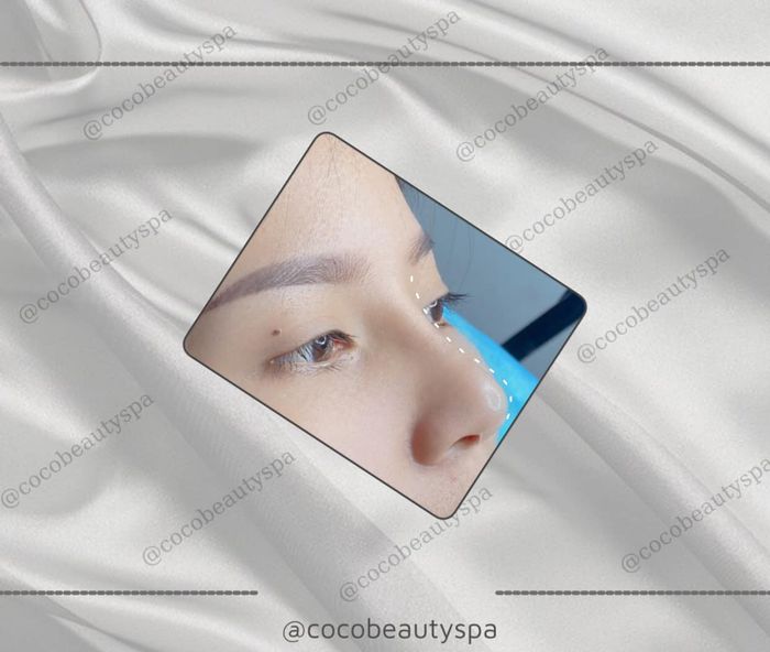 COCO Beauty Spa & Clinic Image 2