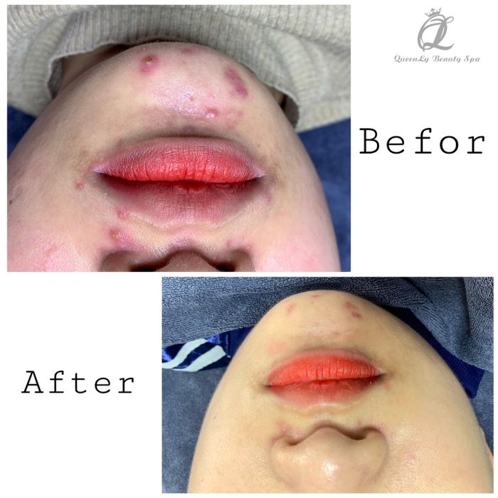 QueenLy Beauty Spa Image 2