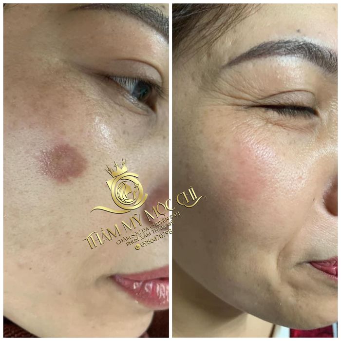 Thẩm Mỹ Mộc Chi Image 2