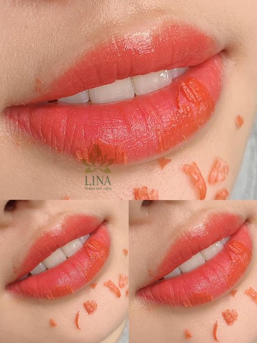 Lina Beauty Clinic Image 1