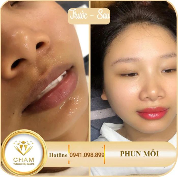 Cham International Aesthetic Clinic image 2