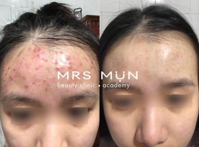 Mrs Mụn Beauty Clinic & Academy Image 1