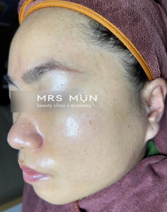 Mrs Mụn Beauty Clinic & Academy Image 2