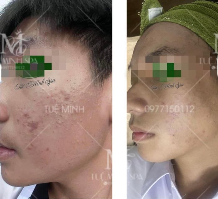 Tuệ Minh Spa image 2