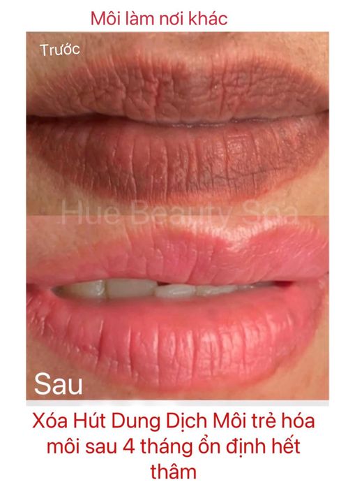 Huệ Spa Beauty Image 1