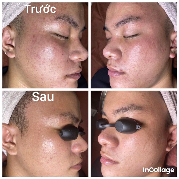 LOUIS SPA DONG HA Image 3