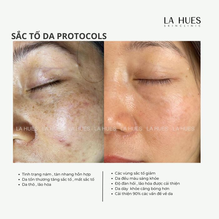 La Hues Spa & Clinic Image 2