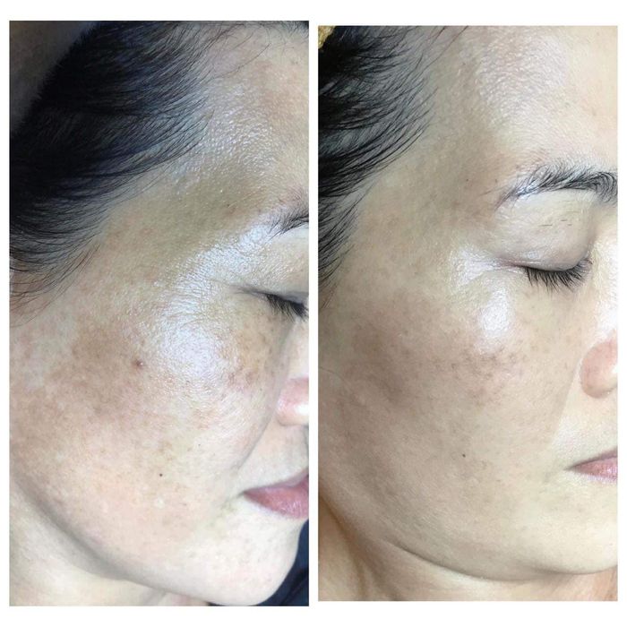 Tuyet Nhung Beauty & Spa Image 2