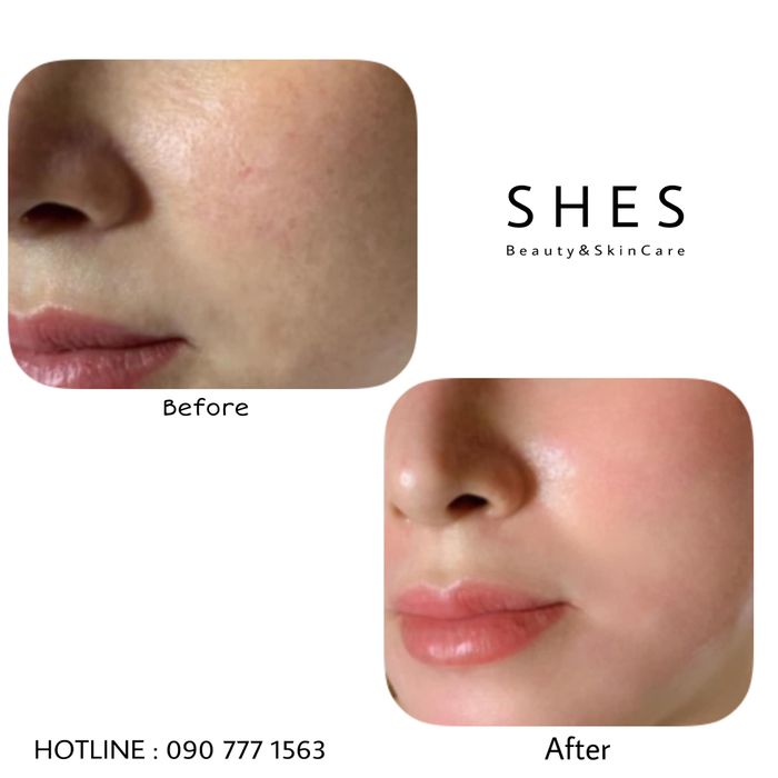 Spa S H E ‘ S Image 2