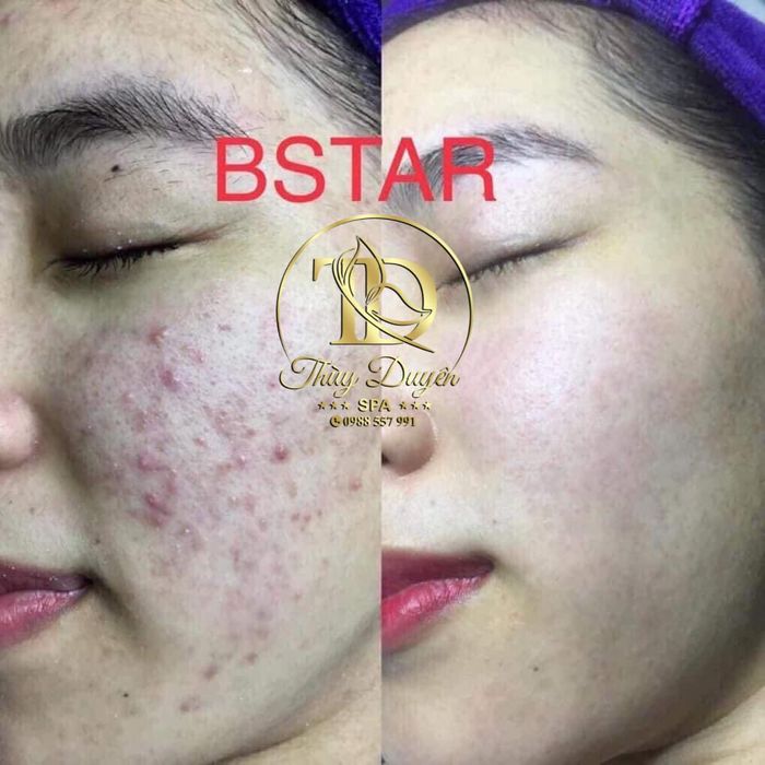 Thuy Duyen Spa Image 2