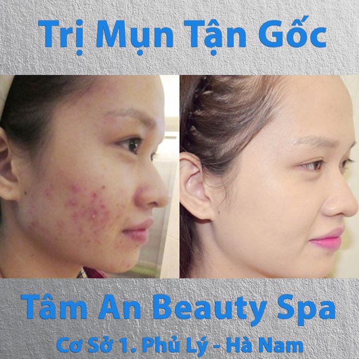 Tâm An Beauty Spa Phủ Lý Hà Nam Image 2