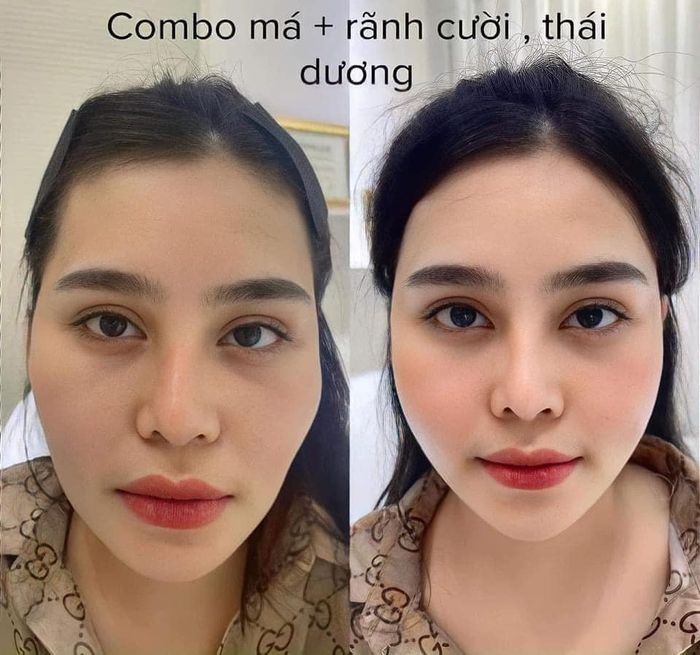 Phuong Spa Soc Trang image 2