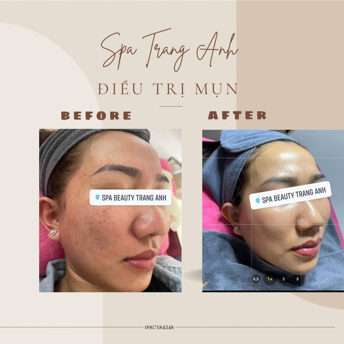 Spa Beauty Trang Anh Image 1