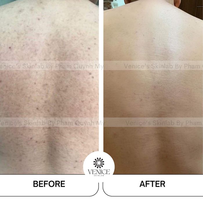 Venice Spa & Beauty Center Phan Rang Image 1