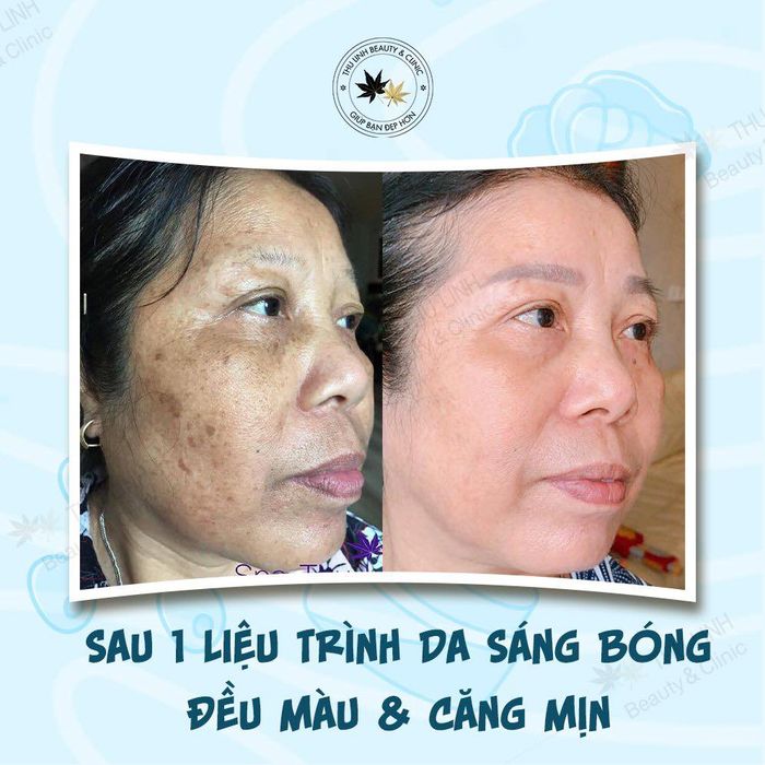 Image 2 of Spa Thu Linh