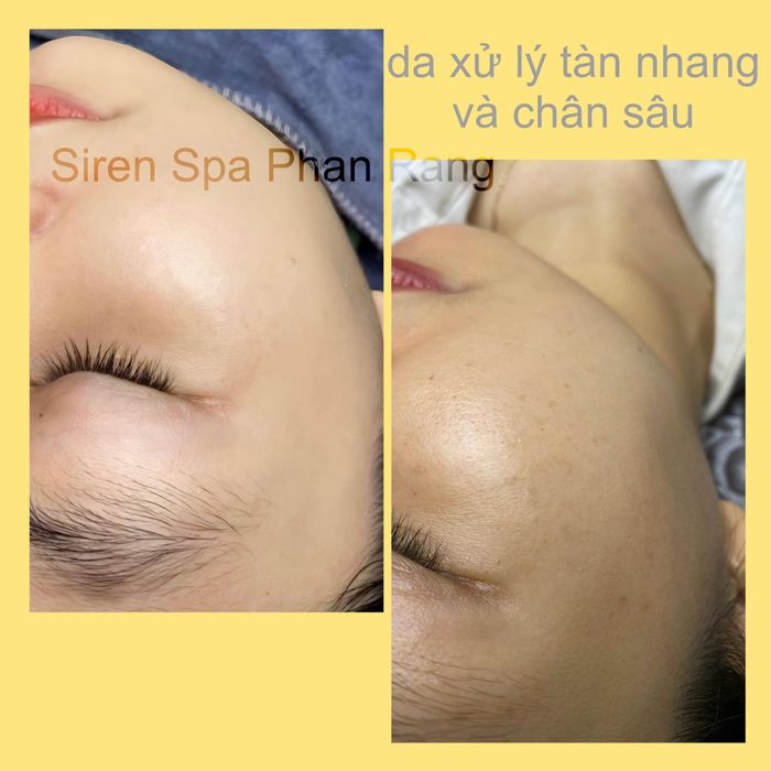 Siren Spa & Clinic Phan Rang Image 2