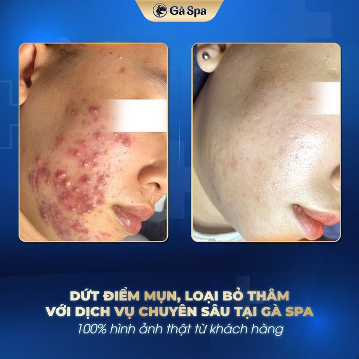 Ga Spa Buon Ma Thuot Image 1