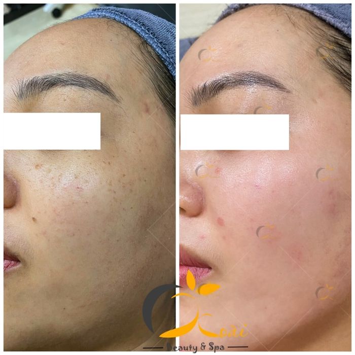 Xoai Beauty & Spa Image 1