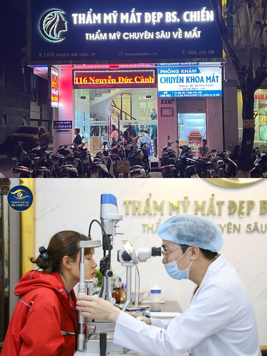 nhan mi cat mi hai phong.png