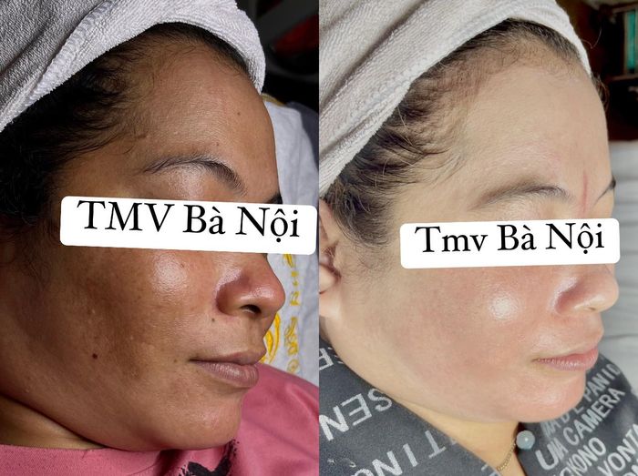 Thẩm mỹ viện Bà Nội 2 ảnh 2