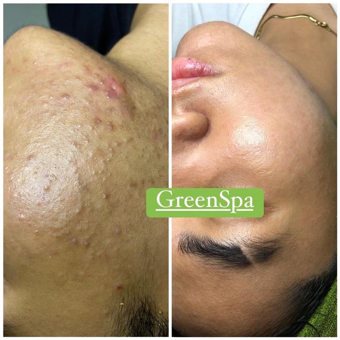 Image 2 of Green Spa