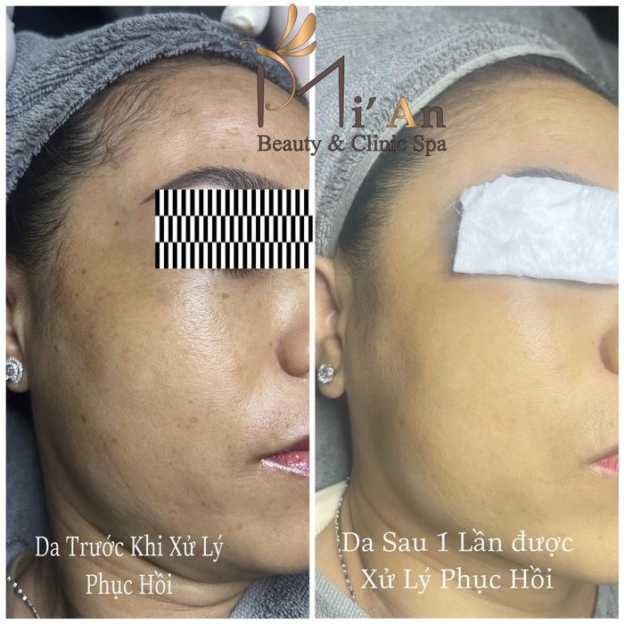 Mi'An Beauty & Clinic Spa Image 2