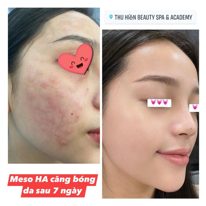 Thu Hiền Beauty Spa image 2