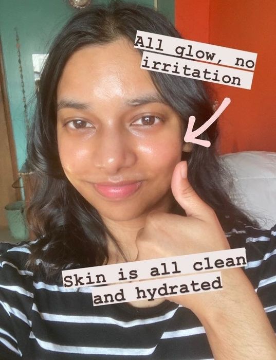 The same Mytour writer showing off her radiant and smooth skin after using the cleansing balm.
