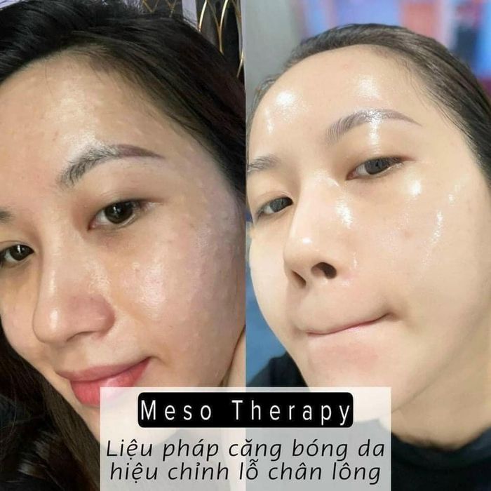 Thao Yuu Beauty & Spa Photo 1