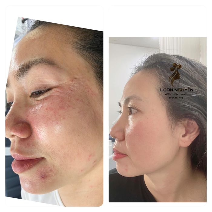 Spa Loan Nguyen image 2