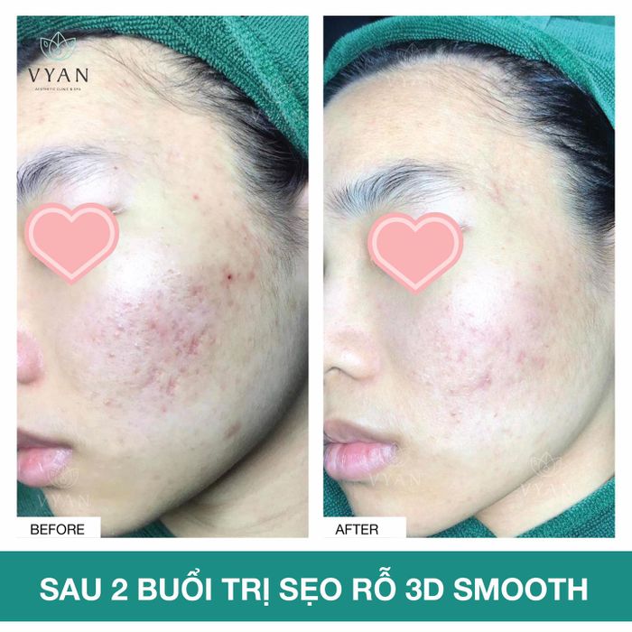 Vy An Spa Image 2