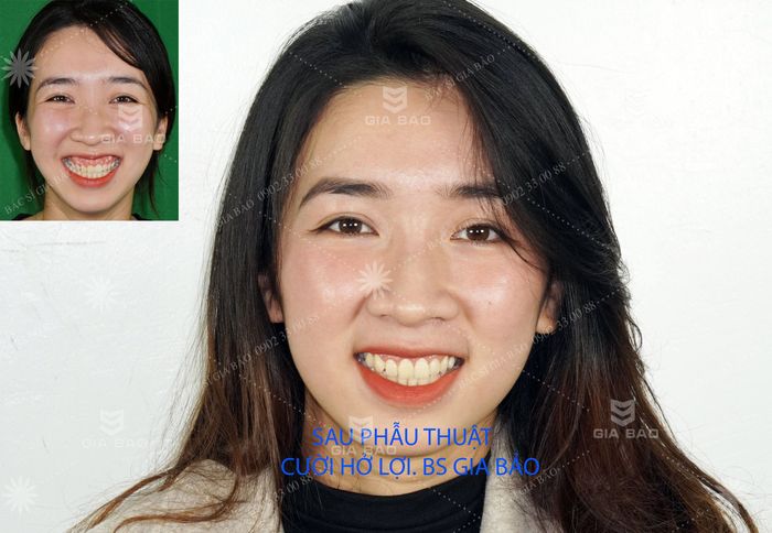 Gia Bao Dental Clinic Hai Phong Image 1