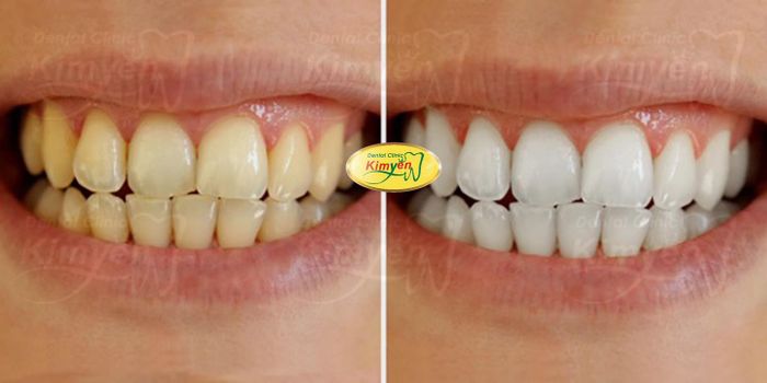Kim Yến Dental Clinic image 2