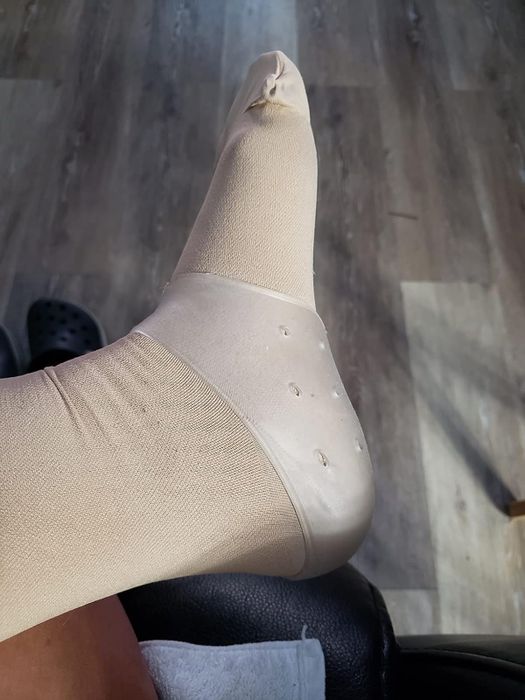 Reviewer's photo of the heel protector