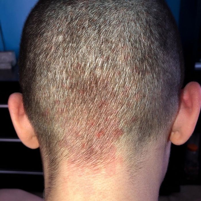 A reviewer before using the comb