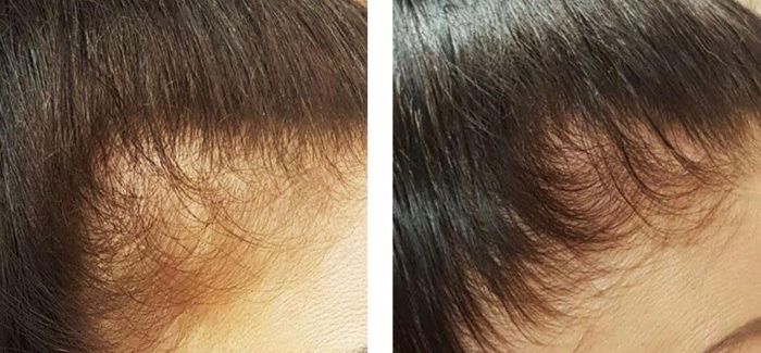 Before and after photos of a reviewer showing significantly thicker hair after using the shampoo