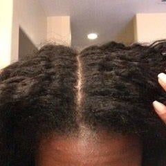 The same reviewer showing a dandruff-free scalp after using the product