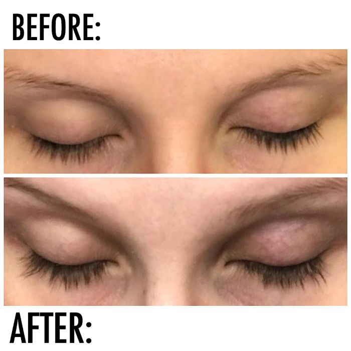 top: reviewer's before photo of short, sparse lashes / bottom: after photo of the same reviewer's longer, thicker lashes after using the serum