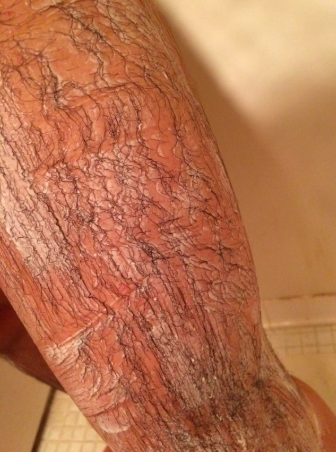 A reviewer's leg with hair visible and the cream applied on top