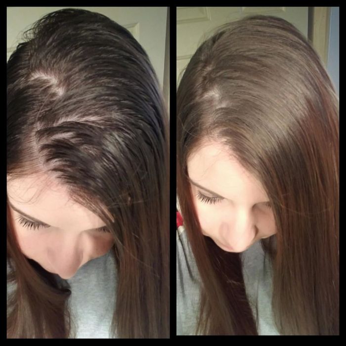 Reviewer's before and after photos demonstrating how the dry shampoo eliminated greasiness at the roots