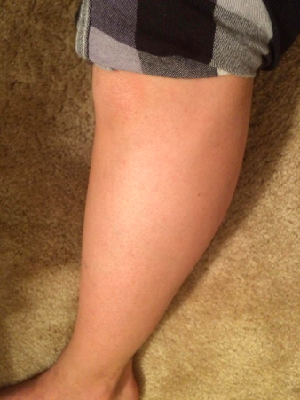 The same leg now perfectly smooth