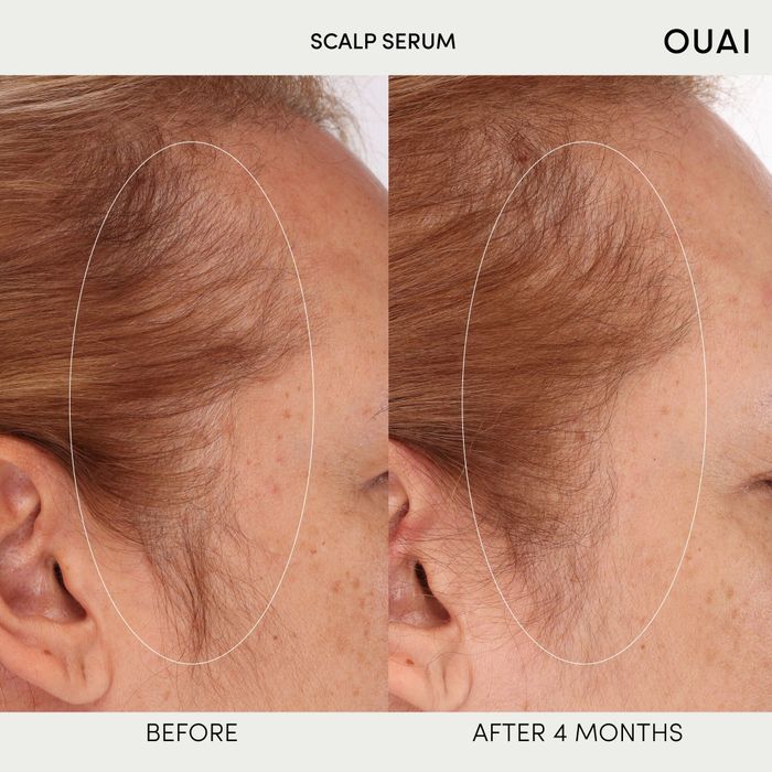 a before-and-after photo using the Ouai Hydrating Scalp Serum
