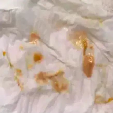 the buildup scraped off a reviewer's tongue