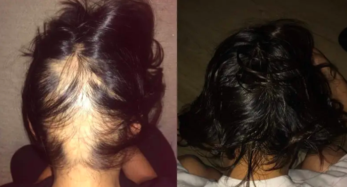 A before-and-after comparison of a reviewer with balding spots, followed by an image showing noticeable hair growth and improved hair health