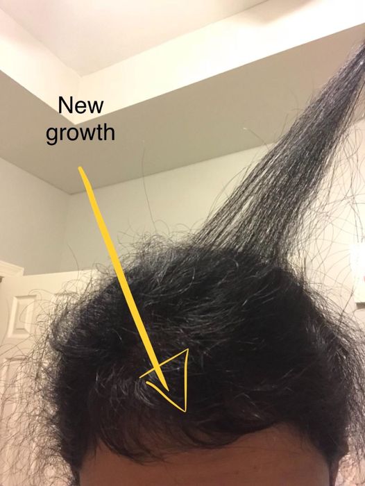 Reviewer demonstrating noticeable new hair growth